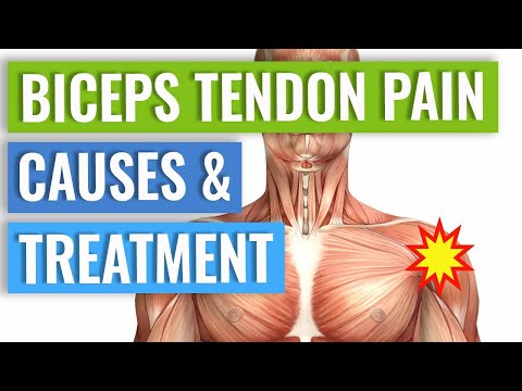 Biceps Tendonitis Treatment and Exercises Explained